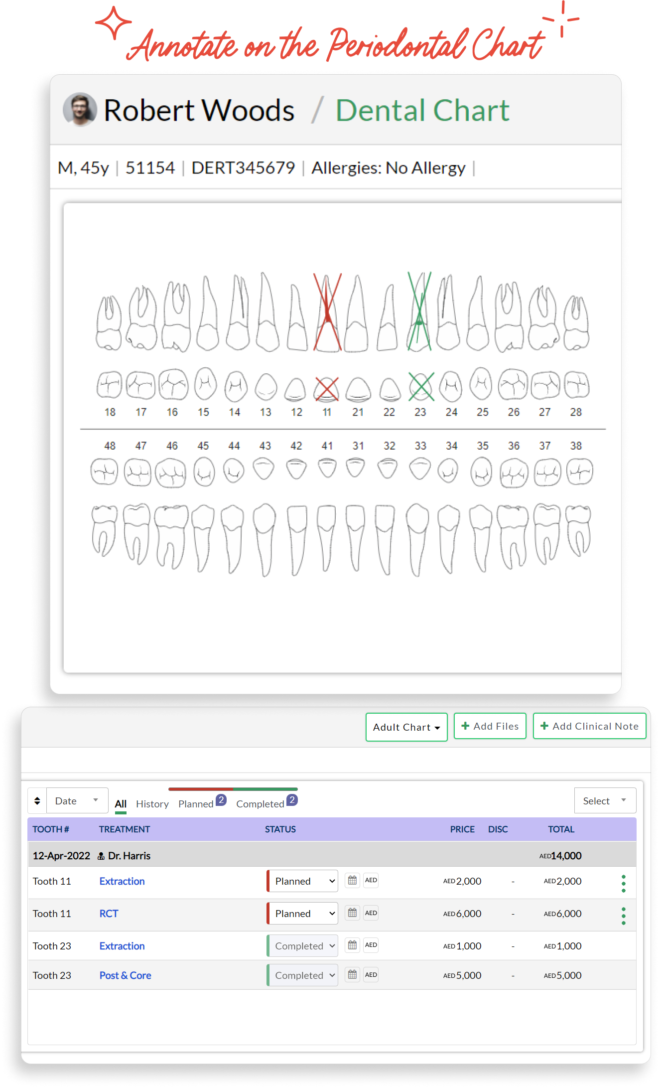 dubai annotate periodontal chart